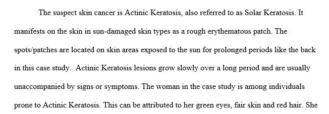 What type of skin cancer is suspect