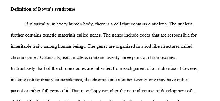 Writing a 2100-2200 Word paper paper of the history of down's syndrome
