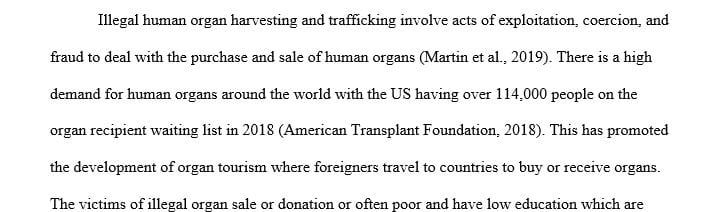 Cause and Effect essay on donating or selling organs, brainstorm general topics of interest